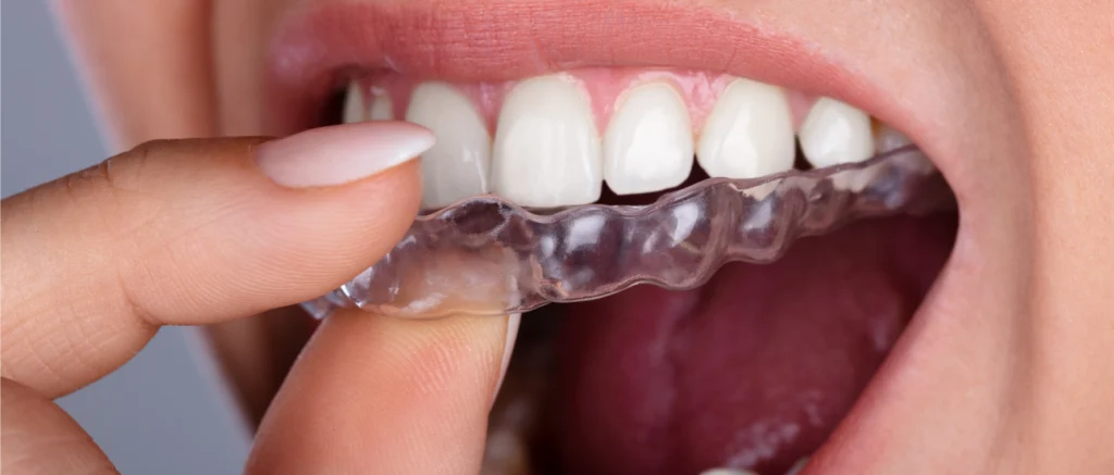 Orthodontiste près de Vernier