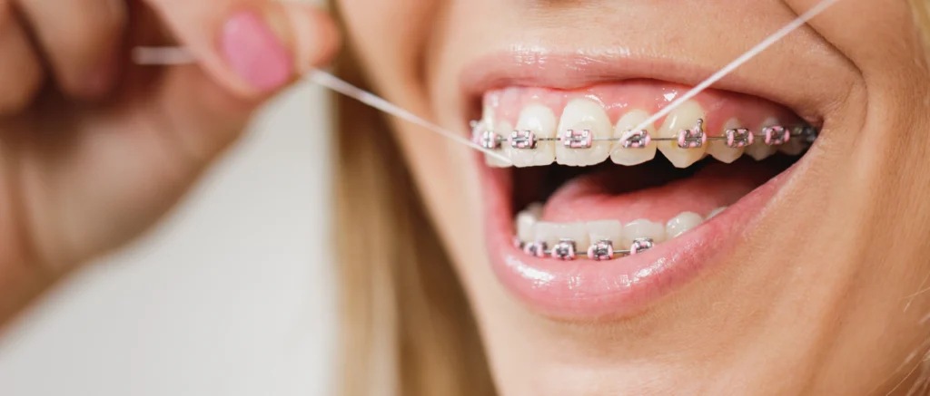 Orthodontiste près de Versoix