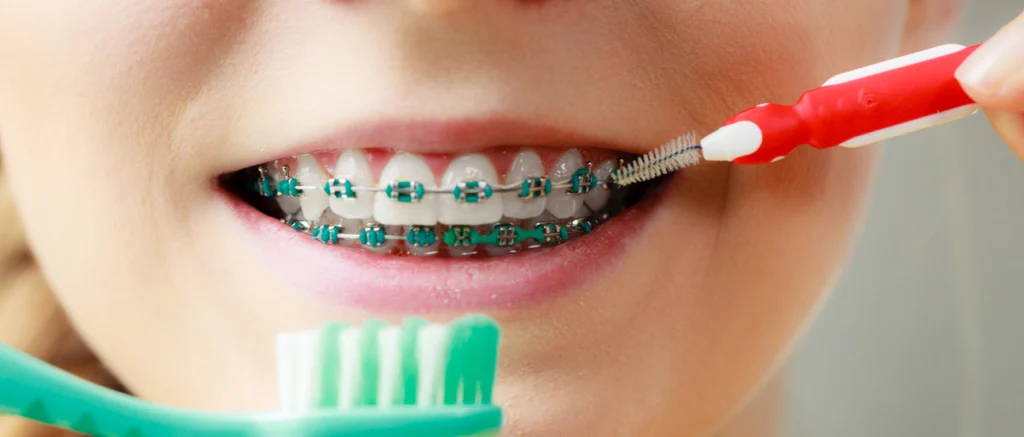 Orthodontiste près de Vernier