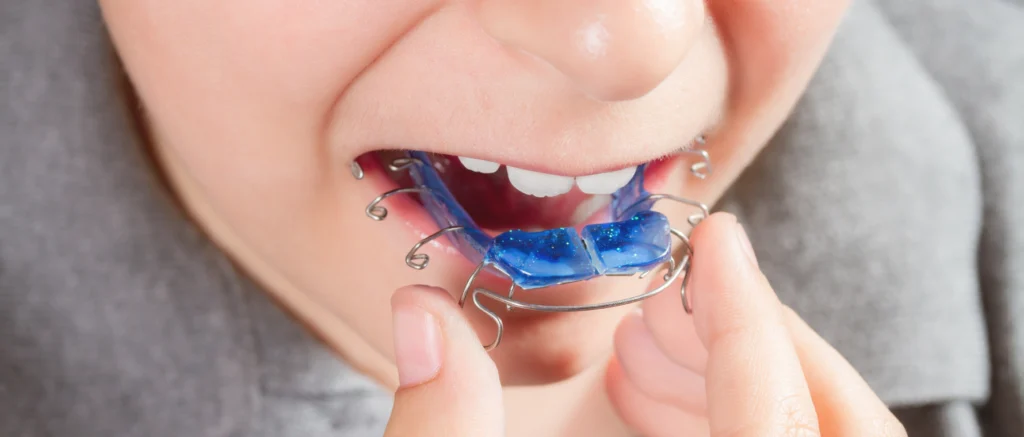 Orthodontiste près de Lancy