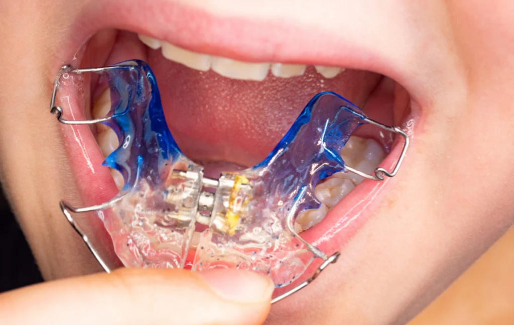 Orthodontiste près de Vernier